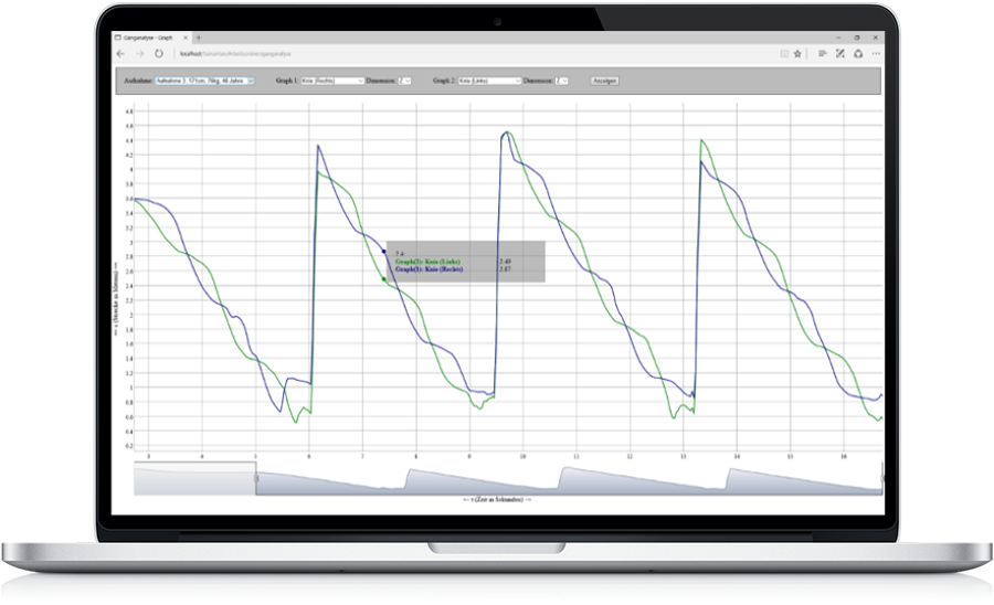 Ganganalyse: Aufnahme und Auswertung